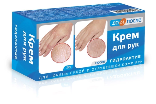 До и После Гидроактив для сухой кожи рук Крем в Казахстане, интернет-аптека Рокет Фарм